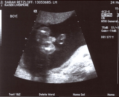 Boys Ultrasound Pictures