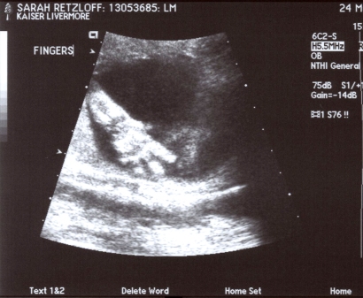 fingers
